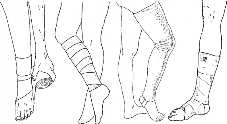 Иллюстрация к книге — Варикозное расширение вен. Лечение традиционными и нетрадиционными методами [_24.jpg]