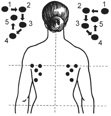 Иллюстрация к книге — Цветопунктура. 40 эффективных схем лечения [imgB80B.jpg]
