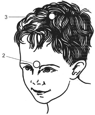 Иллюстрация к книге — Цветопунктура. 40 эффективных схем лечения [imgBFA0.jpg]