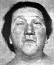 Иллюстрация к книге — Заболевания щитовидной железы. Лечение и профилактика [i_017.jpg]