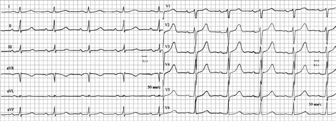 Иллюстрация к книге — Карманный справочник медицинских анализов [Autogen_eBook_id16.jpg]