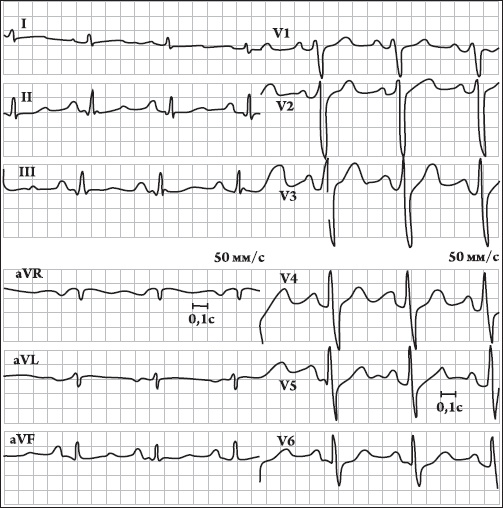 Иллюстрация к книге — Карманный справочник медицинских анализов [Autogen_eBook_id17.jpg]