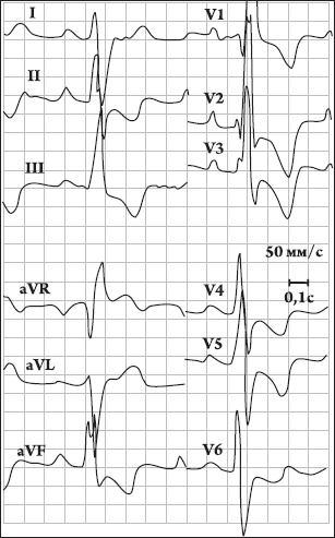 Иллюстрация к книге — Карманный справочник медицинских анализов [Autogen_eBook_id20.jpg]