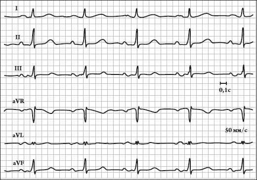 Иллюстрация к книге — Карманный справочник медицинских анализов [Autogen_eBook_id22.jpg]