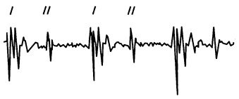 Иллюстрация к книге — Здоровое сердце и сосуды [i_009.jpg]