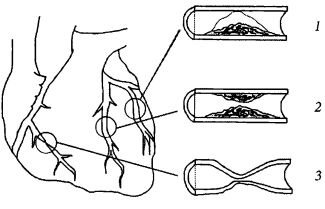 Иллюстрация к книге — Здоровое сердце и сосуды [i_013.jpg]