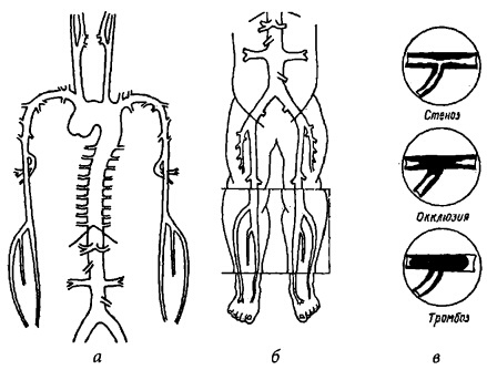 Иллюстрация к книге — Здоровое сердце и сосуды [i_016.jpg]