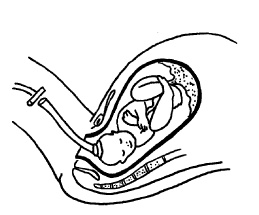 Иллюстрация к книге — Буду мамой! Все о беременности и первом годе жизни малыша. 1000 ответов на 1000 главных вопросов [i_061.jpg]