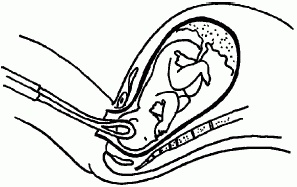 Иллюстрация к книге — 1001 вопрос будущей мамы. Большая книга ответов на все вопросы [i_079.jpg]