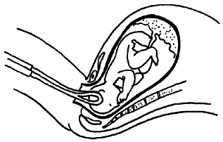 Иллюстрация к книге — Все, что будущая мама хочет знать, но не знает, у кого спросить [i_071.jpg]