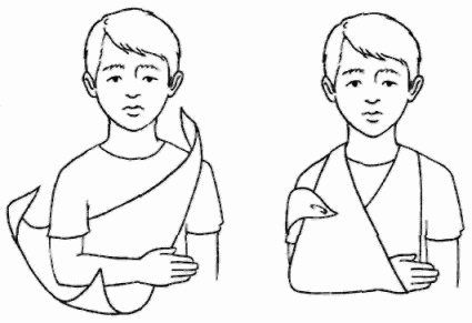 Иллюстрация к книге — Неотложная помощь. Справочник для родителей. Всегда под рукой [i_061.jpg]