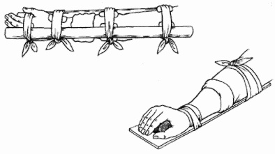 Иллюстрация к книге — Неотложная помощь. Справочник для родителей. Всегда под рукой [i_063.jpg]