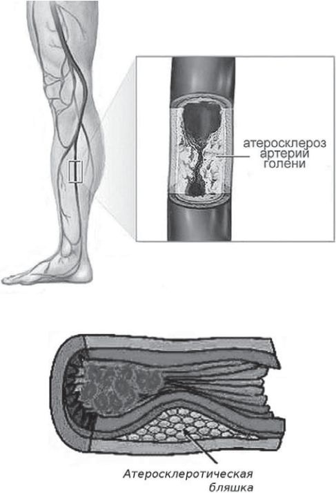 Иллюстрация к книге — Сыроедение против предрассудков. Эволюция в питании человека [i_002.jpg]