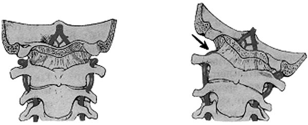 Иллюстрация к книге — Гимнастика для сосудов [Autogen_eBook_id3.jpg]