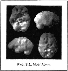 Иллюстрация к книге — Великолепный мозг в любом возрасте [img10.jpg]