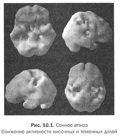 Иллюстрация к книге — Измени свой мозг - изменится и тело! [i_041.jpg]