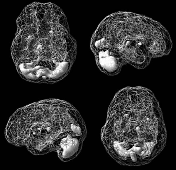 Иллюстрация к книге — Измени свой мозг - изменится и возраст! [i_050.jpg]