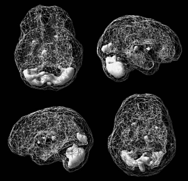 Иллюстрация к книге — Измени свой мозг - изменится и возраст! [i_052.jpg]