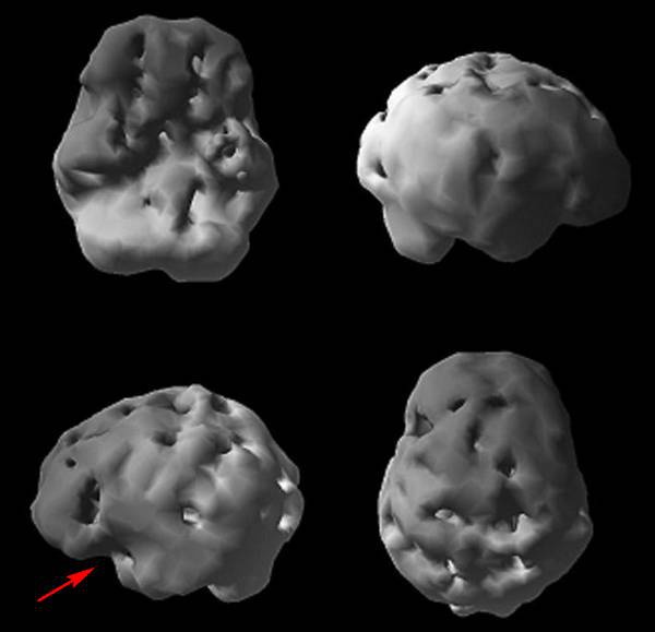 Иллюстрация к книге — Измени свой мозг - изменится и возраст! [i_055.jpg]