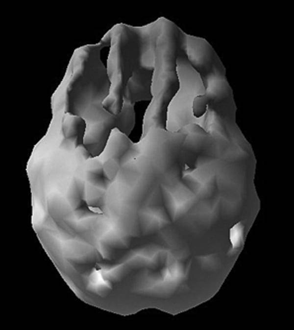 Иллюстрация к книге — Измени свой мозг - изменится и возраст! [i_075.jpg]