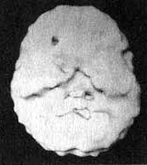 Иллюстрация к книге — Измените свой мозг - изменится и жизнь! [i_007.jpg]