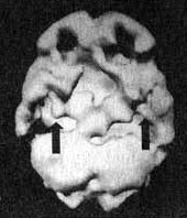 Иллюстрация к книге — Измените свой мозг - изменится и жизнь! [i_017.jpg]