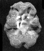 Иллюстрация к книге — Измените свой мозг - изменится и жизнь! [i_021.jpg]