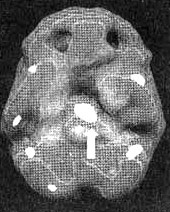 Иллюстрация к книге — Измените свой мозг - изменится и жизнь! [i_022.jpg]