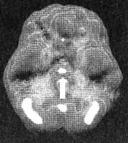 Иллюстрация к книге — Измените свой мозг - изменится и жизнь! [i_023.jpg]