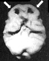 Иллюстрация к книге — Измените свой мозг - изменится и жизнь! [i_026.jpg]