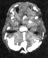 Иллюстрация к книге — Измените свой мозг - изменится и жизнь! [i_031.jpg]