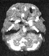 Иллюстрация к книге — Измените свой мозг - изменится и жизнь! [i_038.jpg]