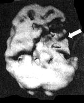Иллюстрация к книге — Измените свой мозг - изменится и жизнь! [i_048.jpg]