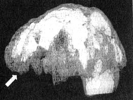 Иллюстрация к книге — Измените свой мозг - изменится и жизнь! [i_052.jpg]