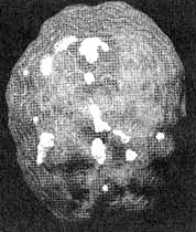 Иллюстрация к книге — Измените свой мозг - изменится и жизнь! [i_062.jpg]