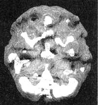 Иллюстрация к книге — Измените свой мозг - изменится и жизнь! [i_065.jpg]