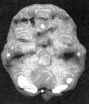 Иллюстрация к книге — Измените свой мозг - изменится и жизнь! [i_066.jpg]