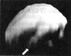 Иллюстрация к книге — Измените свой мозг - изменится и жизнь! [i_070.jpg]