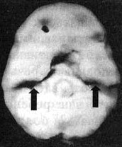 Иллюстрация к книге — Измените свой мозг - изменится и жизнь! [i_071.jpg]