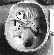 Иллюстрация к книге — Измените свой мозг - изменится и жизнь! [i_073.jpg]