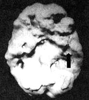 Иллюстрация к книге — Измените свой мозг - изменится и жизнь! [i_074.jpg]