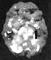 Иллюстрация к книге — Измените свой мозг - изменится и жизнь! [i_075.jpg]
