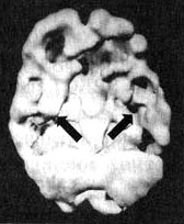 Иллюстрация к книге — Измените свой мозг - изменится и жизнь! [i_076.jpg]