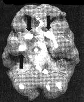 Иллюстрация к книге — Измените свой мозг - изменится и жизнь! [i_079.jpg]