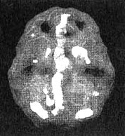 Иллюстрация к книге — Измените свой мозг - изменится и жизнь! [i_082.jpg]