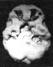 Иллюстрация к книге — Измените свой мозг - изменится и жизнь! [i_093.jpg]