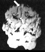 Иллюстрация к книге — Измените свой мозг - изменится и жизнь! [i_094.jpg]