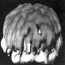 Иллюстрация к книге — Измените свой мозг - изменится и жизнь! [i_095.jpg]