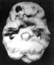 Иллюстрация к книге — Измените свой мозг - изменится и жизнь! [i_104.jpg]