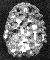 Иллюстрация к книге — Измените свой мозг - изменится и жизнь! [i_107.jpg]